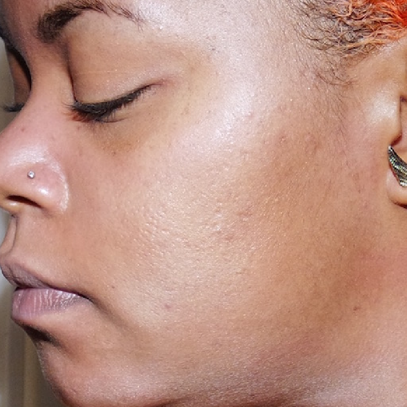 Close-up side profile of a person's face showing clear, smooth skin, with closed eyes, a small nose stud, and a small ear cuff visible.