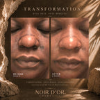 Acne And Blemish Solution - Large